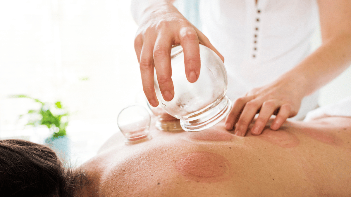 Cupping with Movement