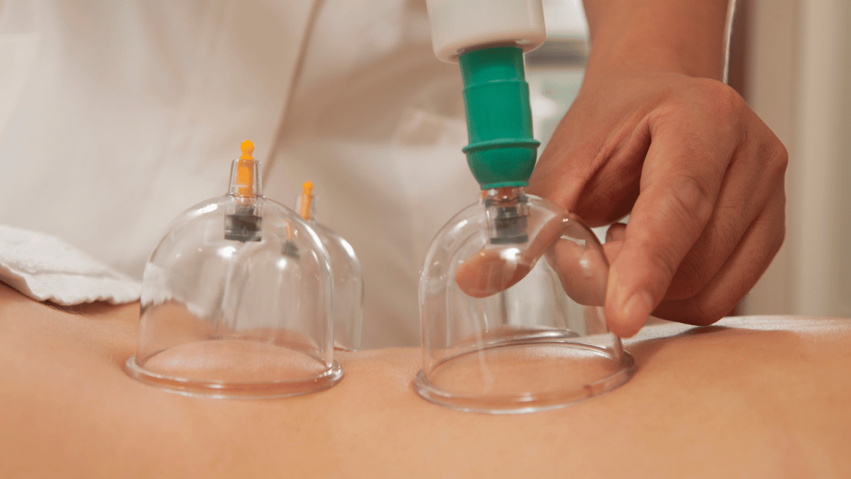 Cupping with Movement