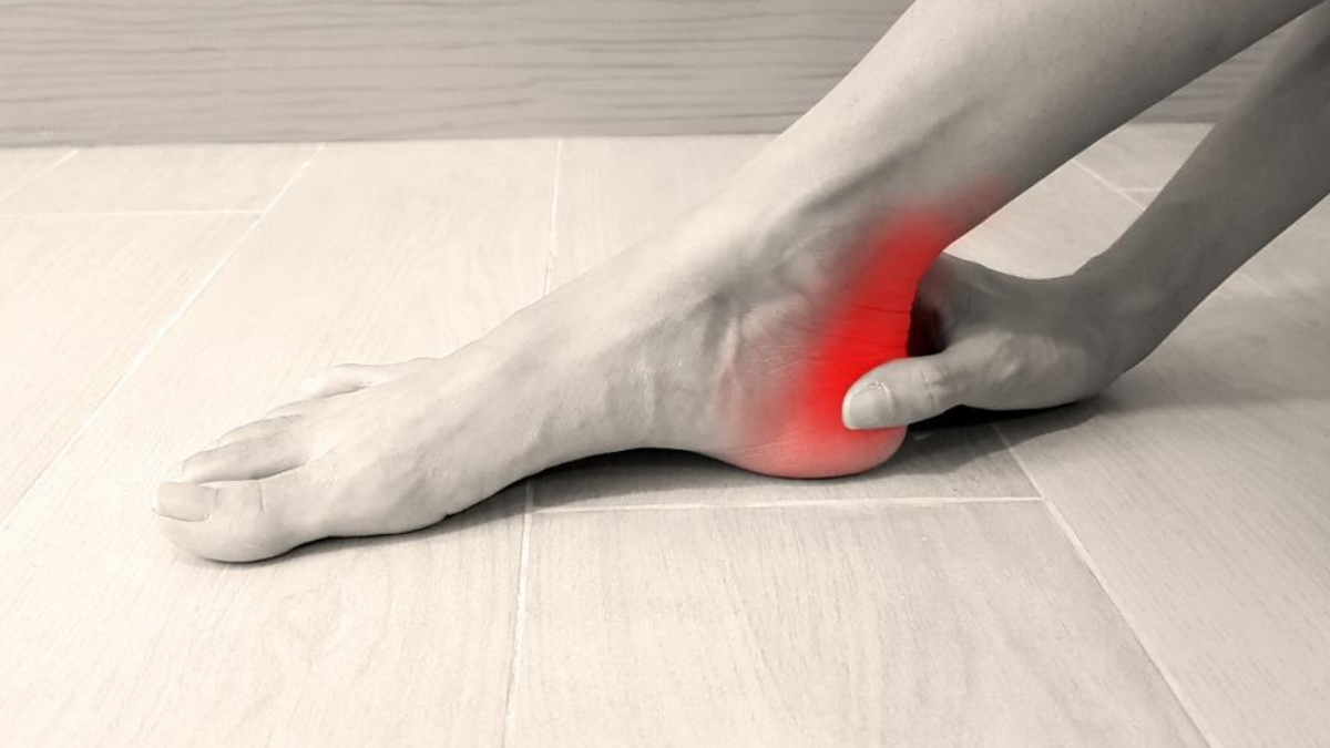 Plantar Fasciitis and the Benefits of Massage — American Massage